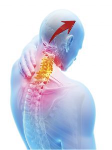 Headache, Motion Works Physiotherapy Stittsville, Stittsville