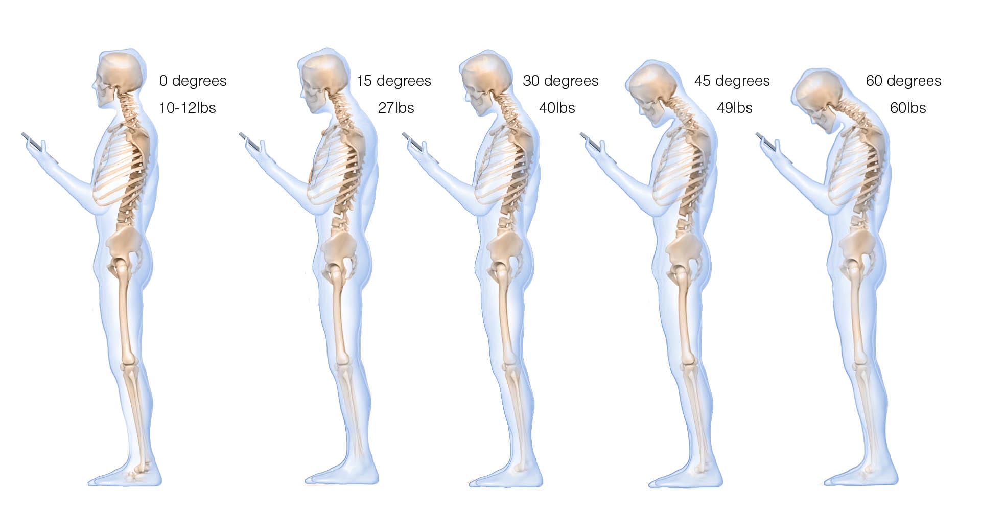 Text Neck, Motion Works Physiotherapy Stittsville, Stittsville Physiotherapist