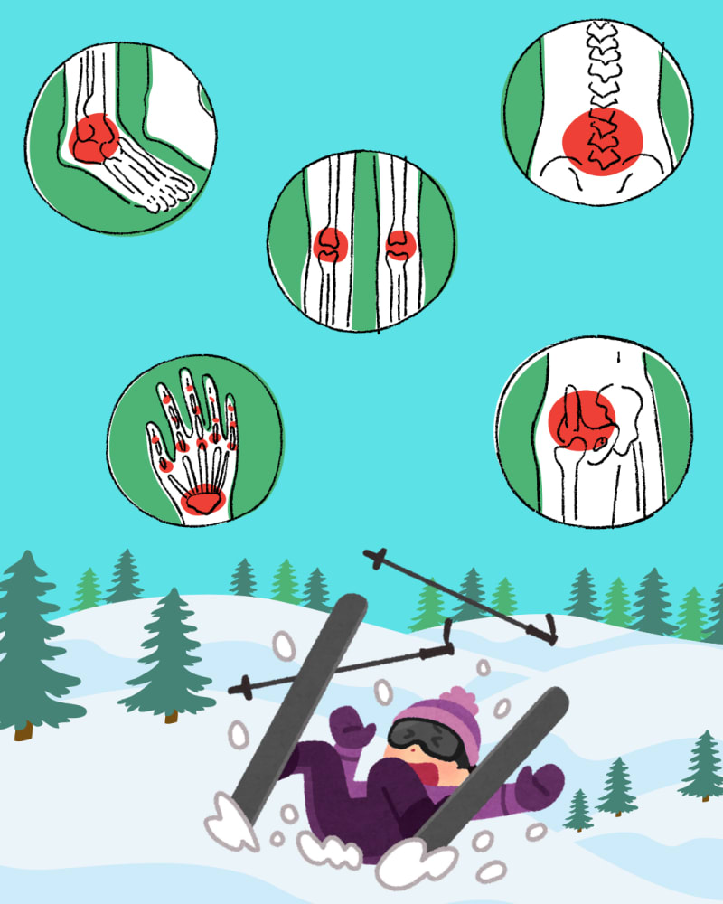 Common Winter Injuries | Motion Works Physiotherapy Stittsville